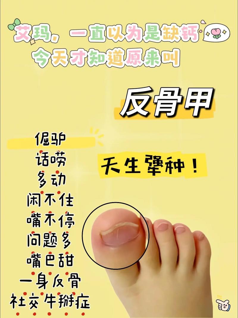 王者榮耀反甲射手克制，王者榮耀誰克反甲-第4張圖片-猴鯊游戲